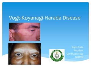 Vogt-Koyanagi-Harada Disease
Bipin Bista
Resident
Ophthalmology
NMCTH
 