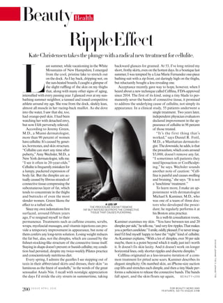 BeautyHealth
L
ast summer, while vacationing in the White
Mountains of New Hampshire, I emerged
from the cool, pristine lake to stretch out
on the dock. As I lay back, dripping wet, on
thesun-heatedboards,Icaughtaglimpseof
the slight ruling of the skin on my thighs
that, along with many other signs of aging,
intensiied with every passing year. I glanced over at my sun-
bathing summer neighbor, a tanned and toned competitive
athlete around my age. She rose from the dock, sleekly lean,
almost all muscle in her racing-back maillot. As she dove
into the water, I saw that she, too,
had orange-peel skin. I had been
watching her with detached envy,
but now I felt perversely relieved.
According to Jeremy Green,
M.D., a Miami dermatologist,
more than 90 percent of women
havecellulite.It’scausedbygenet-
ics, hormones, and skin structure.
“Cellulite can start any time after
puberty,”Amy Wechsler, M.D., a
NewYorkdermatologist,tellsme.
“I see it often in 20-year-olds.”
Celluliteisfrequentlymistakenfor
a lumpy, puckered expression of
body fat. But the dimples are ac-
tuallycausedbyibrousstrandsof
connectivetissuecompressingthe
subcutaneous layer of fat, which
tends to concentrate in the thighs
and buttocks of even the most
slender women. Green likens the
efect to a tufted sofa.
Sincemyownindentationsirst
surfaced, around fifteen years
ago, I’ve resigned myself to their
permanence. Treatments such as caffeine creams, scrubs,
wraps, myofascial massages, and vitamin injections can pro-
vide a temporary improvement in appearance, but none of
them confers any long-term solution. Losing weight reduces
the fat but, alas, not the dimples, which are caused by the
ishnet-stocking-like structure of the connective tissue itself.
Stayinginshapedoesn’tpreventorbanishcellulite;mycondi-
tion had persisted, despite my twice-weekly Pilates practice
and conscientiously nutritious diet.
Every spring, I admire the gazelles I see stepping out of
taxis in their abbreviated skirts and dresses, their skin “as
luminous as the inest of seashells,”in the words of the great
sensualist Anaïs Nin. I recall with nostalgic appreciation
the days I’d stride the city streets in summertime, taking
backward glances for granted. At 53, I’ve long retired my
short,frothyskirts,evenonthehottestdays.Inaboutiquelast
summer,IwastemptedbyaLisaMarieFernandezone-piece
bathing suit with a zip front, cut daringly high on the thighs,
but reluctantly bought a less revealing one.
Acceptance recently gave way to hope, however, when I
heard about a new technique called Cellina, FDA-approved
since 2014. The first of its kind, using a tiny blade to per-
manently sever the bands of connective tissue, it promised
to address the underlying cause of cellulite, not simply its
appearance. In a clinical study, 55 patients underwent a
single treatment. Two years later,
independent physician evaluators
declared improvement in the ap-
pearanceof cellulitein98 percent
of those treated.
“It’s the first thing that’s
worked,” says Daniel R. Foitl,
M.D., a Manhattan dermatolo-
gist.Thedownside,headds,isthat
theprocedure,whichcostsaround
$5,000, doesn’t remove any fat.
“I sometimes tell patients they
need liposuction or CoolSculpt-
ing,” he says. Wechsler sounds
another note of caution: “Cell-
ina is painful and causes swelling
and bruising,”she says. “It is not
a ‘lunchtime’treatment.”
To learn more, I make an ap-
pointment with dermatologist
Michael S. Kaminer, M.D., who
was one of a team of three doc-
tors who developed the proce-
dure; he regularly performs it at
his Boston area practice.
In a well-lit consultation room,
Kaminer examines my skin. “You have between ten and 20
dimplesperside,”hetellsme,“andveryfewripples.Thatmakes
youaperfectcandidate.”Ismile,oddlypleased;I’veneverimag-
ined I’d ind myself happy to have the “right”kind of cellulite.
As Kaminer explains, “With a lot of dimples, over 50 per side
maybe, there is a point beyond which it really just isn’t worth
it. It doesn’t fix skin laxity. And it doesn’t work on longer
horizontal lines, only shorter ripples and discrete dimples.”
Cellina originated as a less-invasive iteration of a com-
mon treatment for pitted acne scars. Kaminer describes its
elegant simplicity: On numbed skin, an iPhone-size suction
cup lifts and stretches each dimple, and then a tiny blade per-
forms a subcision to release the connective bands. The bands
fall apart, and the skin floats up again,
A LEG UP
THE PROCEDURE DOESN’T REMOVE
FAT BUT INSTEAD DESTROYS THE CONNECTIVE
TISSUE THAT CAUSES PUCKERING.
RippleEffect
KateChristensentakestheplungewitharadicalnewtreatmentforcellulite.
B E AU T Y>20 6
BILLBRANDT©BILLBRANDTARCHIVE
200 V O G U E A P R I L 2 0 1 6 FOR BEAUT Y NEWS AND
FEATURES, GO TO VOGUE.COM
 
