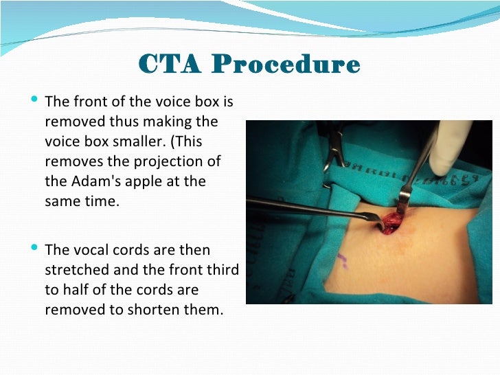 Voice change surgerymale to female or vice versa. Contact yanhee_en…