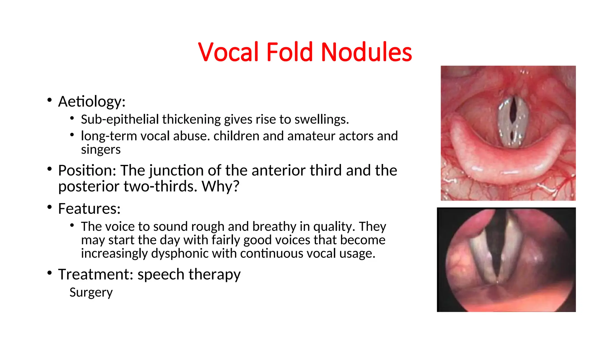 Voice disorders for students2..... (2).ppt