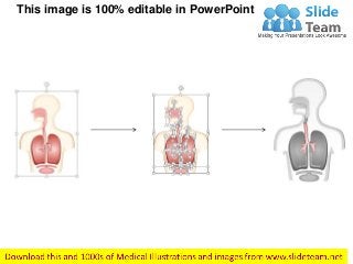 This image is 100% editable in PowerPoint
 