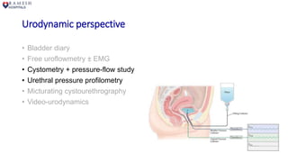 Urodynamic perspective
• Bladder diary
• Free uroflowmetry ± EMG
• Cystometry + pressure-flow study
• Urethral pressure profilometry
• Micturating cystourethrography
• Video-urodynamics
 