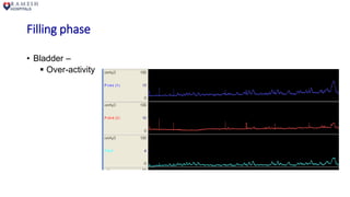 Filling phase
• Bladder –
 Over-activity
 