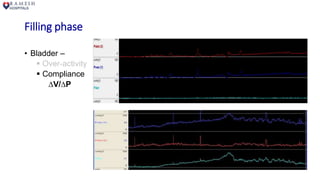 Filling phase
• Bladder –
 Over-activity
 Compliance
∆V/∆P
 