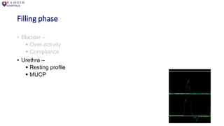 Filling phase
• Bladder –
 Over-activity
 Compliance
• Urethra –
 Resting profile
 MUCP
 