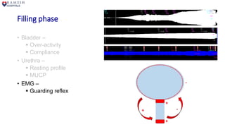 Filling phase
• Bladder –
 Over-activity
 Compliance
• Urethra –
 Resting profile
 MUCP
• EMG –
 Guarding reflex
 