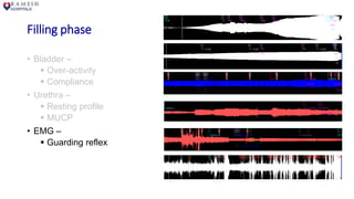 Filling phase
• Bladder –
 Over-activity
 Compliance
• Urethra –
 Resting profile
 MUCP
• EMG –
 Guarding reflex
 