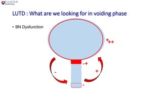 LUTD : What are we looking for in voiding phase
• BN Dysfunction
-
-
+
- +
+
++
 