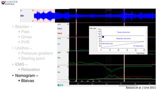 • Bladder –
 Pdet
 Qmax
 PVR
• Urethra –
 Pressure gradient
 Starting point
• EMG –
 Relaxation
• Nomogram –
 Blaivas
Batavia et al. J Urol 2011
 