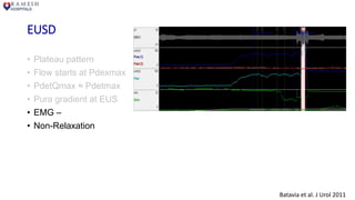 EUSD
• Plateau pattern
• Flow starts at Pdexmax
• PdetQmax ≈ Pdetmax
• Pura gradient at EUS
• EMG –
• Non-Relaxation
Batavia et al. J Urol 2011
 