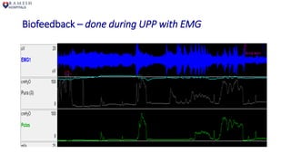 Biofeedback – done during UPP with EMG
 