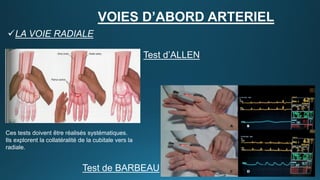 Voies d'abord artériel et systèmes de fermeture artérielle | PDF
