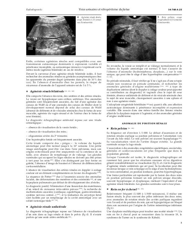 Voies Urinaires Et Retroperitoine Du Fœtus