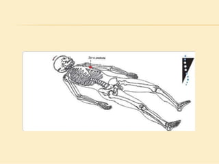 Método o Terapia Vojta