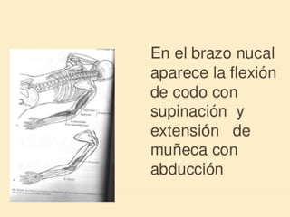 Método o Terapia Vojta
