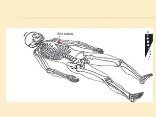 Método o Terapia Vojta