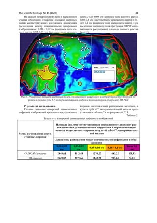 The scientific heritage No 45 (2020) 41
На каждой поверхности культи в выделенном
участке проводили измерение площади цветовых
полей, соответствующих следующим диапазонам
расхождения между совмещенными цифровыми
изображениями: 0,00 – 0,02 мм (цветовое поле си-
него цвета), 0,02-0,05 мм (цветовое поле зеленого
цвета), 0,05-0,08 мм (цветовое поле желтого цвета),
0,08-0,1 мм (цветовое поле оранжевого цвета) и бо-
лее 0,1 мм (цветовое поле малинового цвета). При
выделение цветового поля программа 3D PDF авто-
матически рассчитывает площадь данного участка
(рис. 5).
Рис. 5. Измерение площади цветовых полей совмещенного цифрового изображения искусственной ко-
ронки и культи зуба 4.7 экспериментальной модели в компьютерной программе 3D PDF
Результаты исследования.
Средние значения измерений совмещенных
цифровых изображений временных искусственных
коронок, изготовленных различными методами, и
культи зуба 4.7 экспериментальной модели пред-
ставлены в таблице 2 и на рисунках 6, 7, 8.
Таблица 2.
Результаты измерений совмещенных цифровых изображений
Метод изготовления искус-
ственных коронок
Площадь (кв. мм), соответствующая определенному диапазону рас-
хождения между совмещенными цифровыми изображениями вре-
менных искусственных коронок и культей зуба 4.7 эксперименталь-
ной модели
Диапазоны расхождения между совмещенными цифровыми изобра-
жениями
0,00-0,02
мм
0,02-0,05
мм
0,05-0,08 мм 0,08 - 0,1 мм
Более 0,1
мм
CAD/CAM система 2848,61 3113,43 1270,27 483,22 175,33
3D принтер 2649,85 3199,66 1243,72 703,63 94,01
 