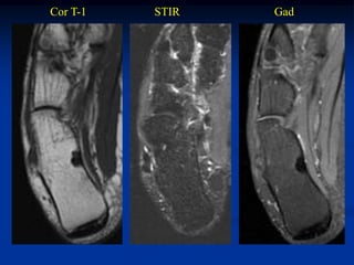 Cor T-1   STIR   Gad
 