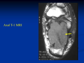 Axal T-1 MRI
 