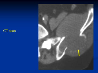 CT scan
 