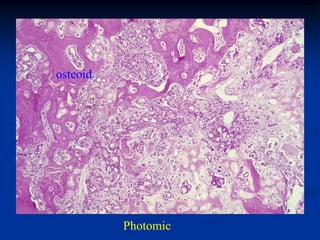 osteoid




          Photomic
 