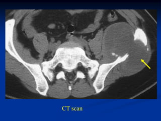 CT scan
 
