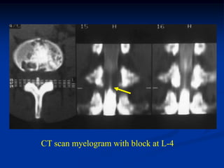 CT scan myelogram with block at L-4
 
