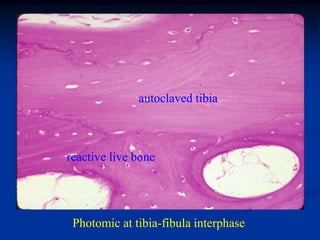 autoclaved tibia



reactive live bone




 Photomic at tibia-fibula interphase
 