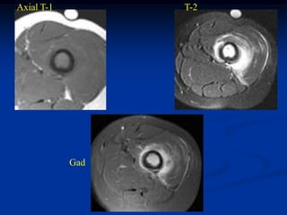 Axial T-1         T-2




            Gad
 