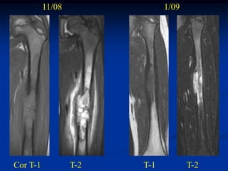 11/08               1/09




Cor T-1           T-2   T-1          T-2
 