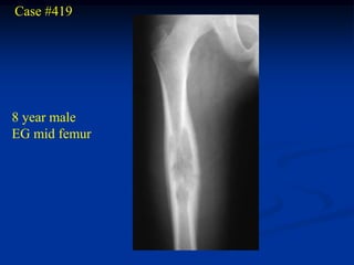 Case #419




8 year male
EG mid femur
 