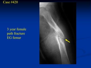 Case #420




  3 year female
  path fracture
  EG femur
 