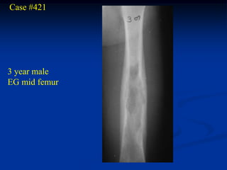 Case #421




3 year male
EG mid femur
 