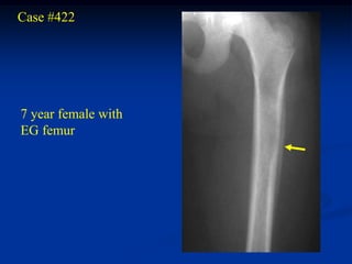 Case #422




7 year female with
EG femur
 