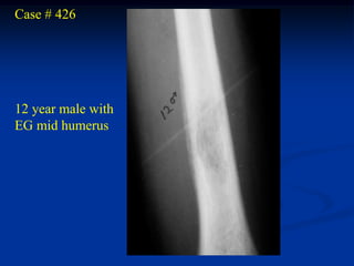 Case # 426




12 year male with
EG mid humerus
 