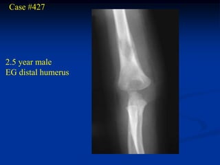 Case #427




2.5 year male
EG distal humerus
 