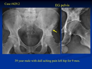 Case #429.2
                                        EG pelvis




       39 year male with dull aching pain left hip for 9 mos.
 