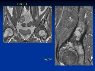 Cor T-1




          Sag T-2
 