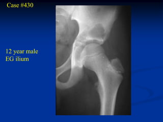 Case #430




12 year male
EG ilium
 
