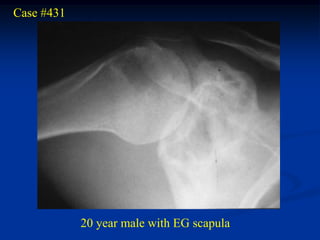 Case #431




            20 year male with EG scapula
 