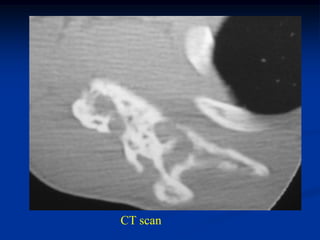 CT scan
 