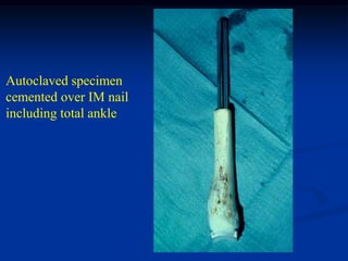Autoclaved specimen
cemented over IM nail
including total ankle
 