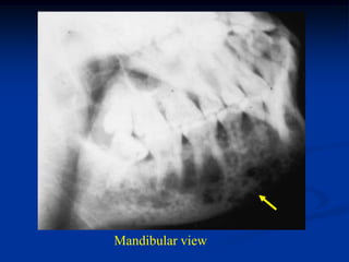 Mandibular view
 
