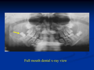 Full mouth dental x-ray view
 