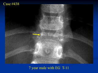 Case #438




            7 year male with EG T-11
 