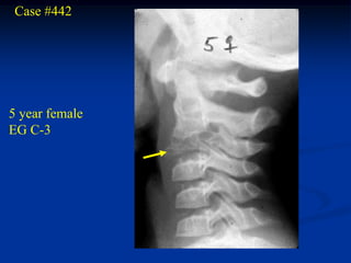 Case #442




5 year female
EG C-3
 