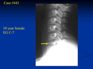 Case #443




10 year female
EG C-7
 