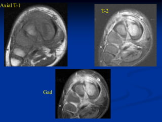 Axial T-1
                  T-2




            Gad
 