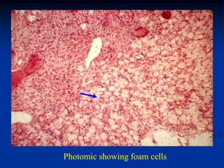 Photomic showing foam cells
 