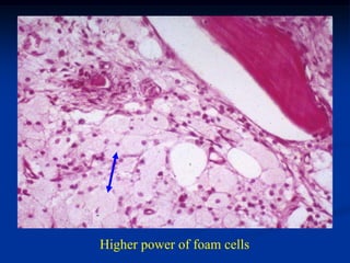 Higher power of foam cells
 